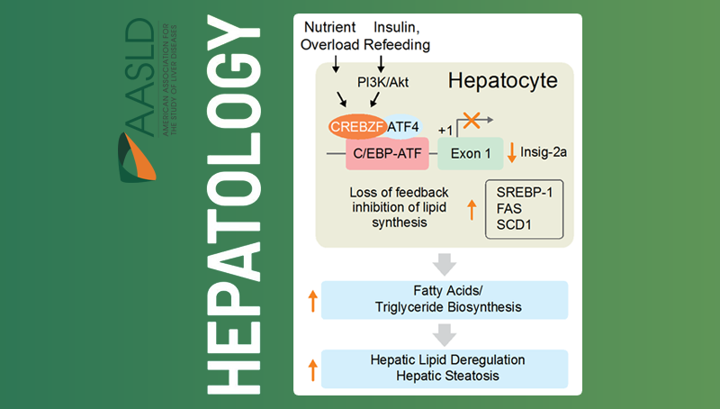 李于研究組發現治療非酒精性脂肪肝合并胰島素抵抗的新靶點