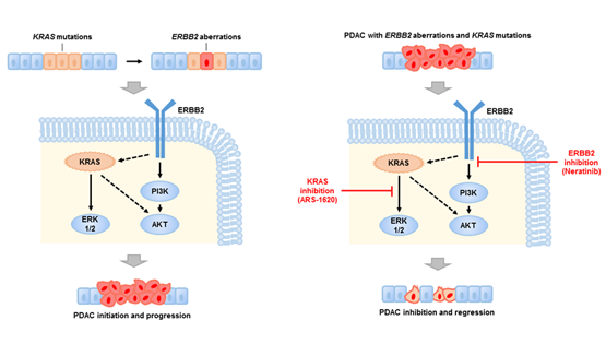 王躍祥研究組發(fā)現(xiàn)胰腺癌的新型治療靶點
