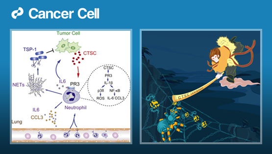胡國宏研究組發現乳腺癌肺轉移調控的新機制