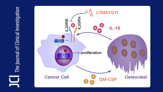 營養與健康所胡國宏研究組發現肺癌骨轉移調控新機制