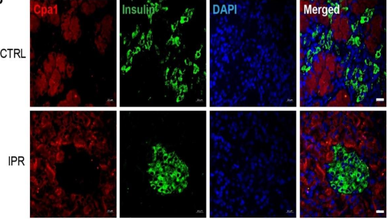 營養與健康所陳雁研究組發現間歇性蛋白限制能在大鼠模型上改善2型糖尿病