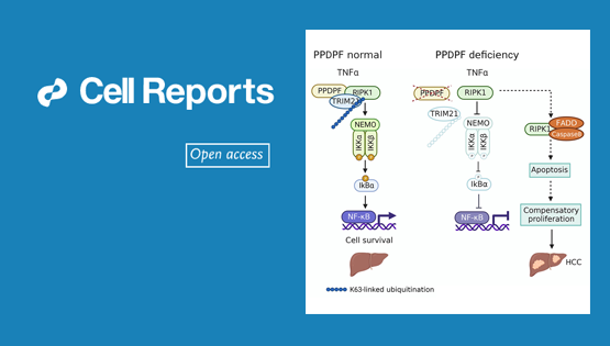 營養與健康所謝東研究組揭示PPDPF調控肝癌的新機制