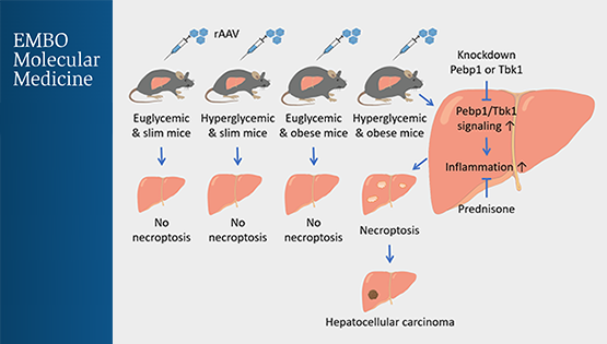 營養與健康所翟琦巍研究組揭示預防肥胖的糖尿病人肝癌發生的新思路以及AAV基因治療的新問題