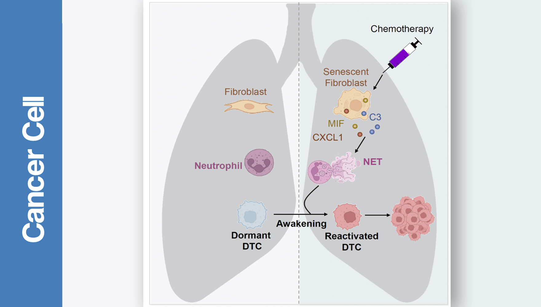 營養與健康所胡國宏研究組揭示化療喚醒休眠乳腺癌細胞導致轉移復發